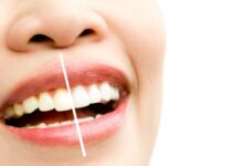 osmetic Dentist Sydney