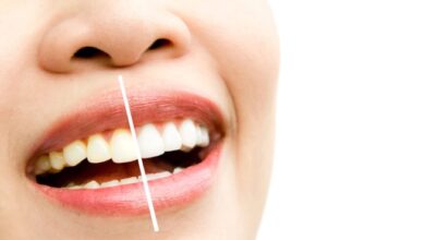 osmetic Dentist Sydney