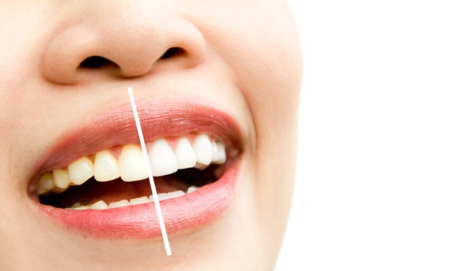 osmetic Dentist Sydney