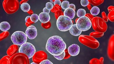 aplastic-anemia
