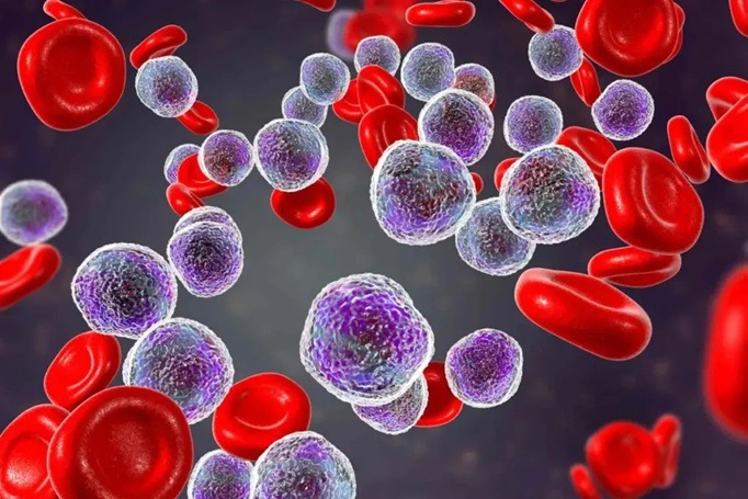 aplastic-anemia